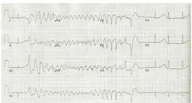 electromancia 20