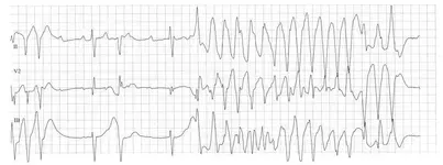 Electromancia 36