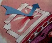 Manejo del Neumotorax aspirativo.