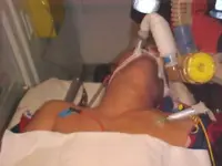 Descompresión de neumotórax a tensión
