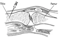 Reanimación Neonatal