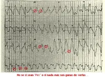 Electromancia 44