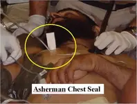 Atención al trauma en combate