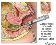 Le dolía " un harto", y luego se desmayó...