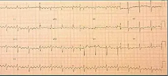 Electromancia 2