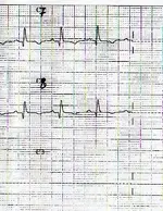 Electromancia nº 57