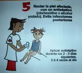 Animales ponzoñosos.