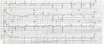 Electromancia nº 67