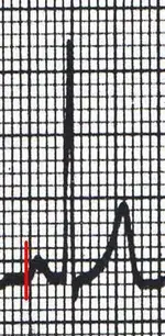 Electromancia nº 77