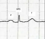 Ecg nº1 del curso para principiantes
