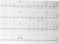 Ecg nº1 del curso para principiantes