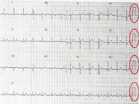 Ecg nº1 del curso para principiantes