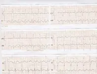 Electromancia 80