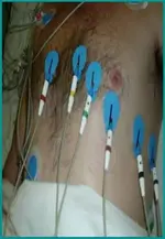 Ecg nº2 del curso para principiantes