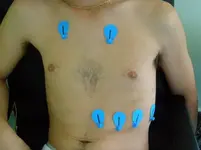 Ecg nº2 del curso para principiantes