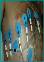 Ecg nº3 para principiantes