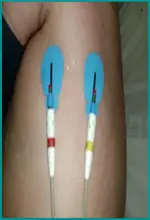 Ecg nº3 para principiantes