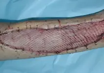 Animales ponzoñosos.