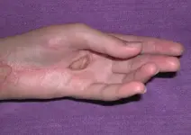 Animales ponzoñosos.