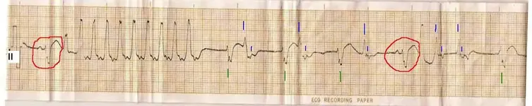 Electromancia 83