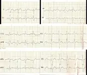 Electromancia 84