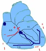 Ecg nº 10 para principiantes