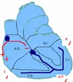Ecg nº 10 para principiantes