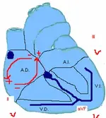 Ecg nº 10 para principiantes
