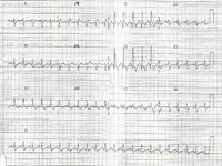 Electromancia nº 85