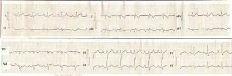 Electromancia 88...quedan solo 12!!!!!