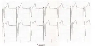 Electromancia 90