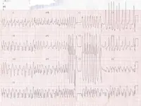 Electromancia nº 91