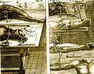 Arte y medicina. "El enfermo"