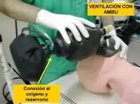 Boca a boca y cánula de Guedel