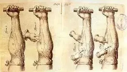 Arte y Medicina: "La lección de anatomía".