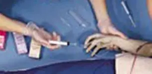 ¿Cuál es el error? (técnica correcta de Desfibrilación con palas)