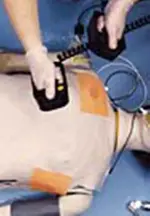 ¿Cuál es el error? (técnica correcta de Desfibrilación con palas)