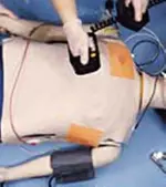 ¿Cuál es el error? (técnica correcta de Desfibrilación con palas)