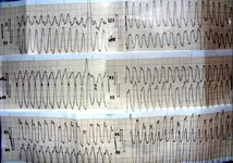 Paciente con dolor torácico y disnea.