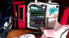 LUCAS: un dispositivo de ayuda al masaje cardíaco externo