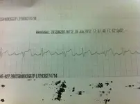 Necesito ayuda con un electrocardiograma