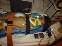 Inmovilización pediátrica