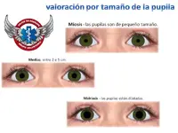 Evaluacion pupilas