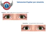 Evaluacion pupilas