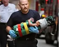 Inmovilización pediátrica