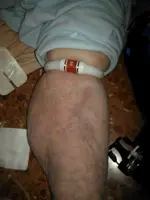 Sistema de Constricción I.V.