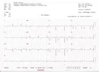Ayuda con caso clínico, me urge y no sé ni por donde empezar