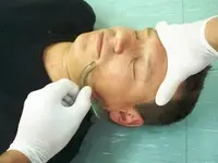 ¿técnica de medición mas adecuada/correcta de la cánula de guedel?