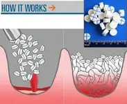 NUEVOS AGENTES HEMOSTÁTICOS PARA EL CONTROL DE LA HEMORRAGIA EN COMBATE