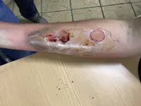 Taller de simulación del trauma para instructores
